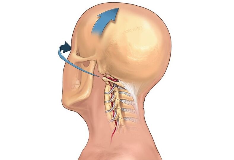 krčenje vratu pri obračanju glave kot simptom cervikalne osteohondroze