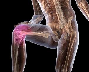 Vnetje kolenskega sklepa z artrozo