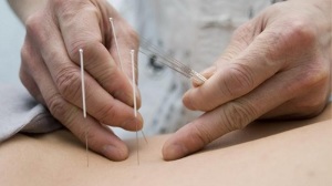 akupunktura za ledveno osteohondrozo