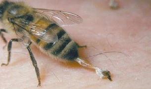 zdravljenje artroze kolka s čebelami