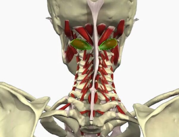 Sindrom vertebralne arterije