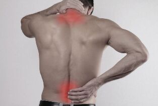 Bolečine v hrbtu